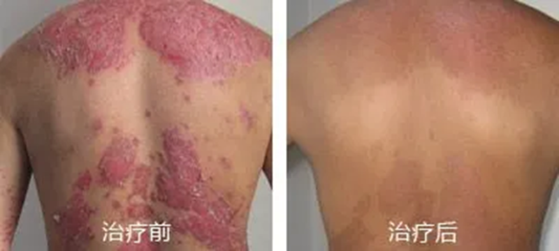 邢台皮肤病医院,您身边的皮肤卫士